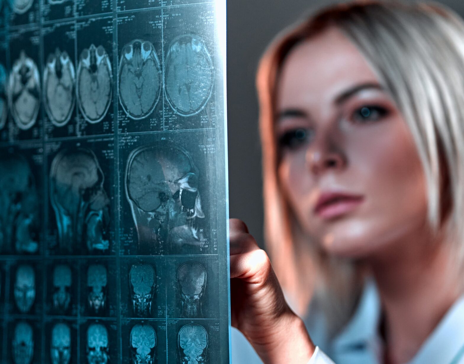 traumatic brain injury after a car crash
