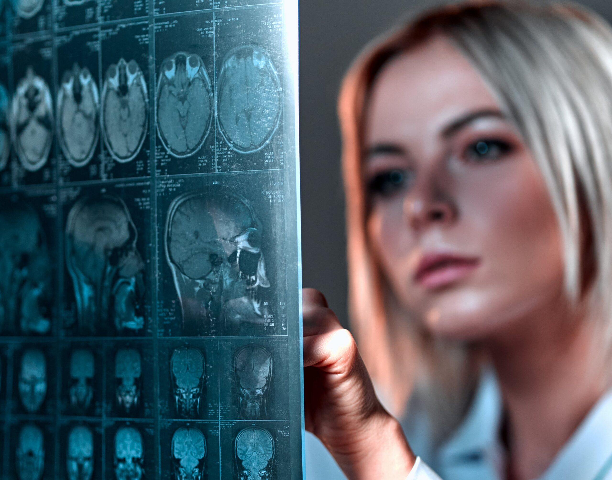 traumatic brain injury after a car crash