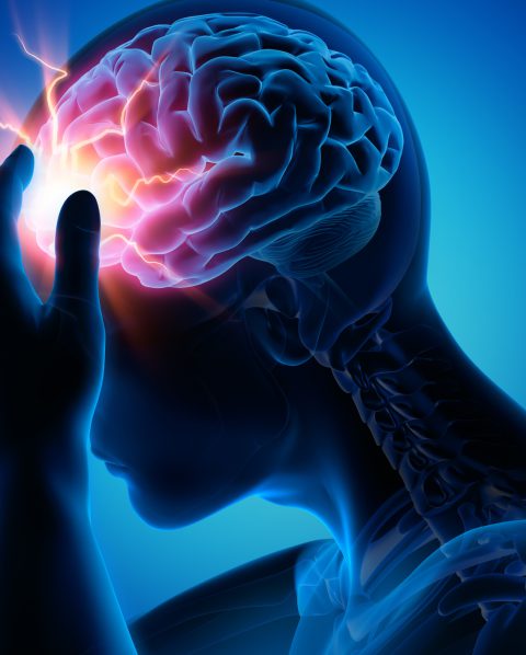 Severe Headache - Migraine - Medical Illustration - 3D Rendering